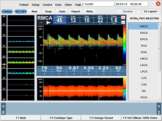 x15 Doppler Transcraneal NeuroVascular DTC